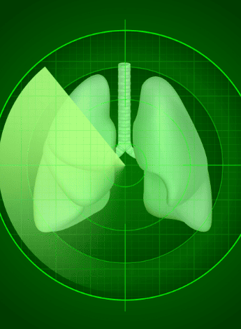 The photo is a stylised image of lungs overlaid with a circular gauge . 